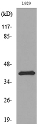 Anti-PDGFD Antibody