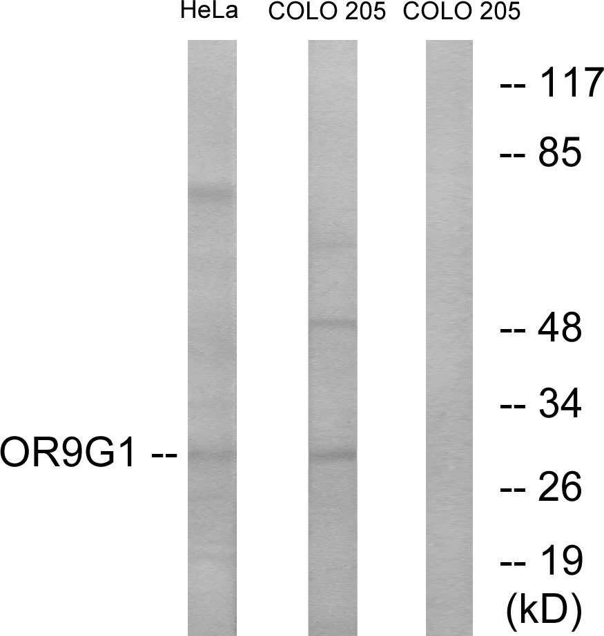Anti-OR9G1 Antibody