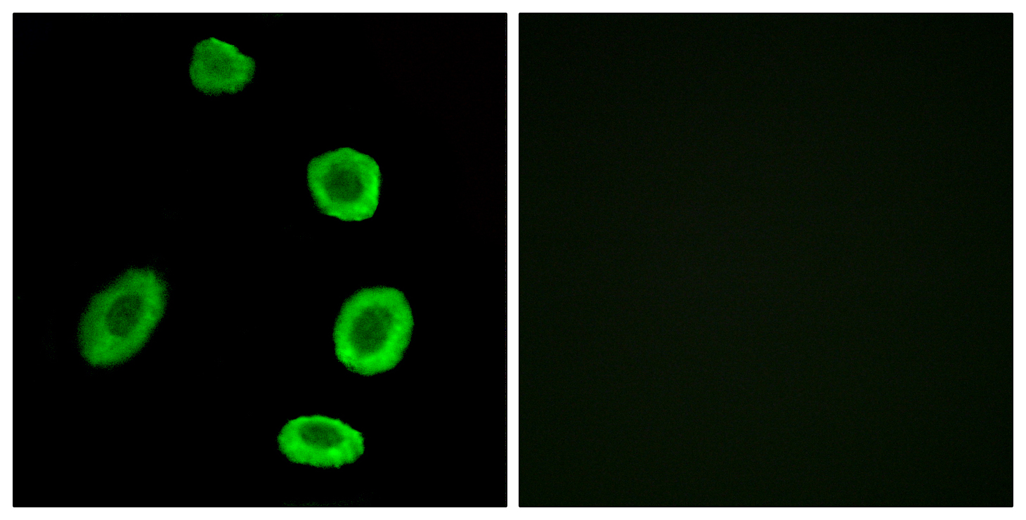 Anti-OR8K1 Antibody