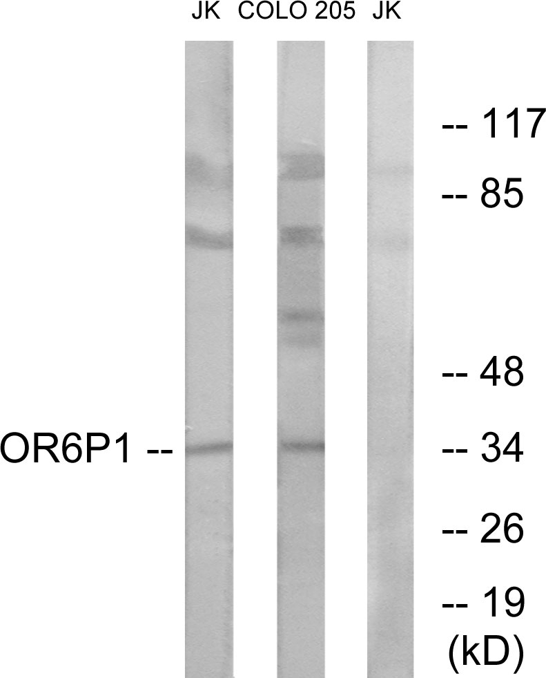 Anti-OR6P1 Antibody