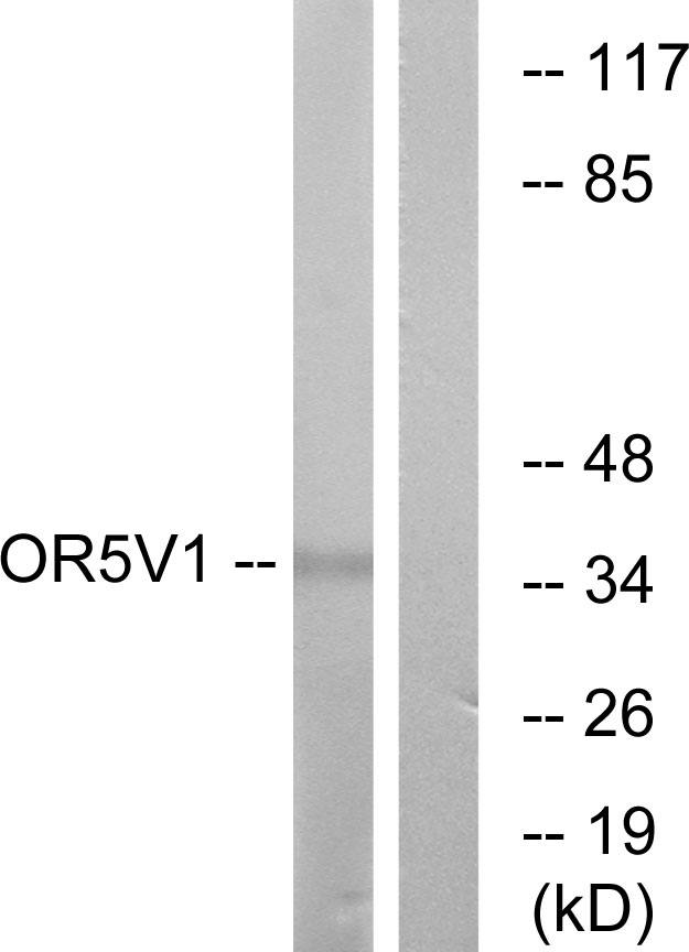 Anti-OR5V1 Antibody
