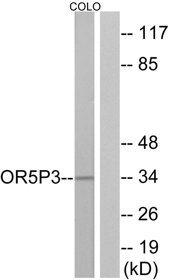 Anti-OR5P3 Antibody