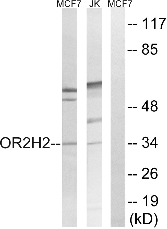 Anti-OR2H2 Antibody