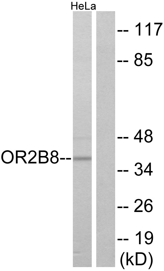 Anti-OR2B8 Antibody