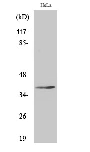 Anti-NKX24 Antibody