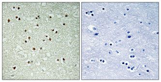 Anti-NCOA7 Antibody Anti-NCOA7 Antibody