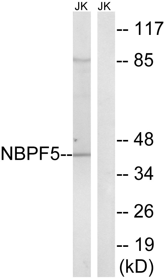 Anti-NBPF5 Antibody