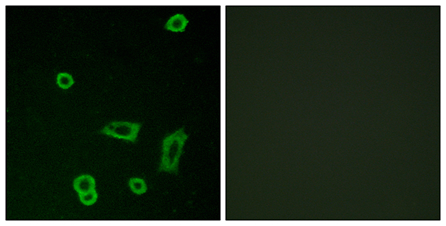 Anti-MTR1L Antibody