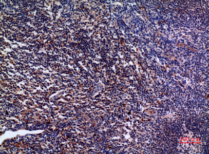 Anti-IL28A Antibody Anti-IL28A Antibody