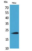 Anti-IFNW1 Antibody Anti-IFNW1 Antibody