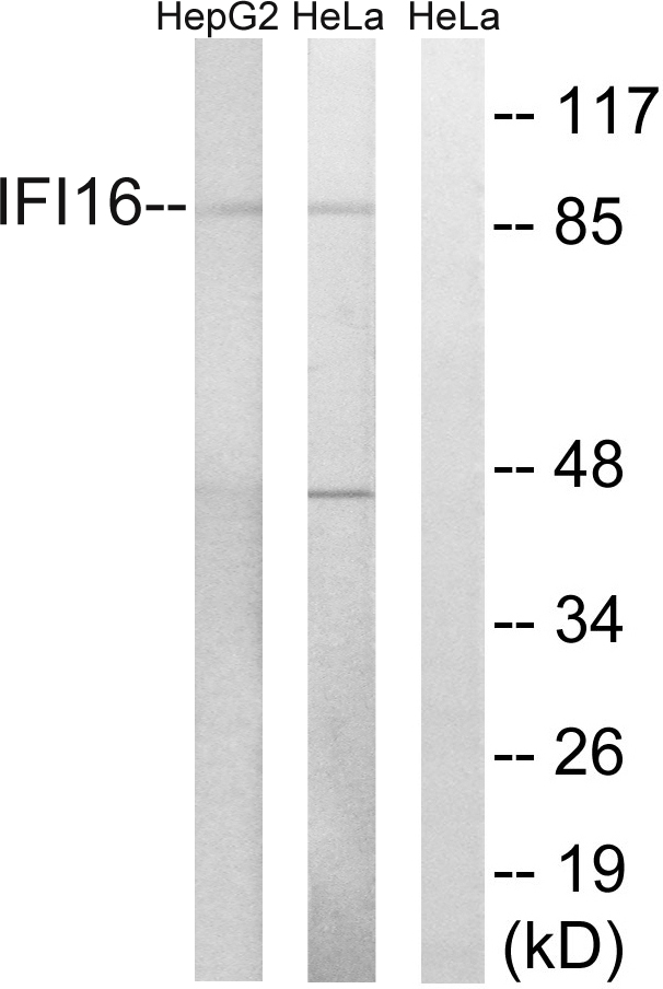 Anti-IFI16 Antibody