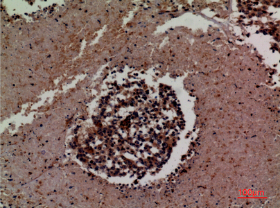 Anti-ICAM3 Antibody Anti-ICAM3 Antibody