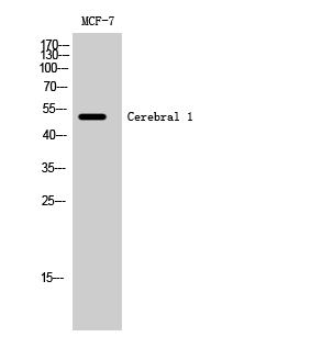 Anti-HUCE1 Antibody Anti-HUCE1 Antibody