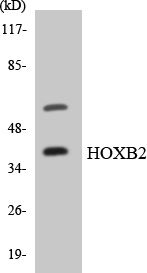 Anti-HOXB2 Antibody - Identical to Abcam (ab136856)