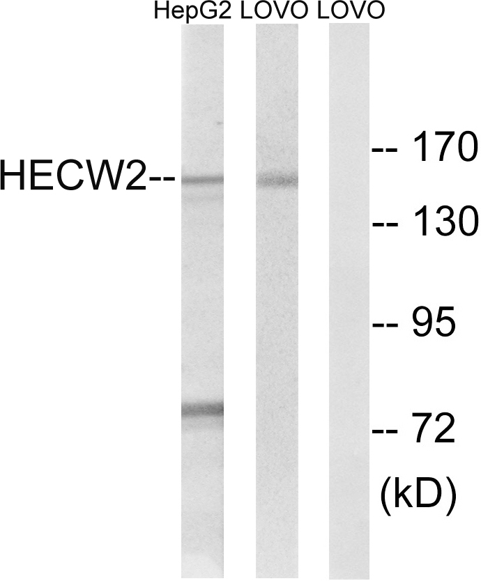 Anti-HECW2 Antibody