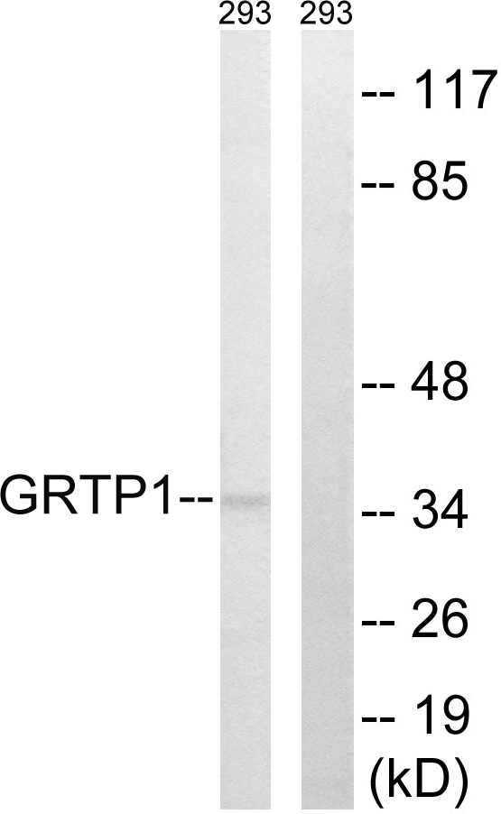 Anti-GRTP1 Antibody