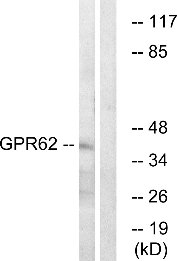 Anti-GPR62 Antibody