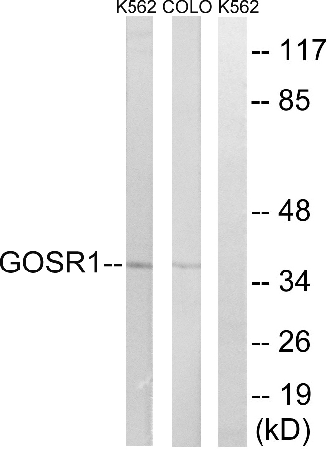 Anti-GOSR1 Antibody