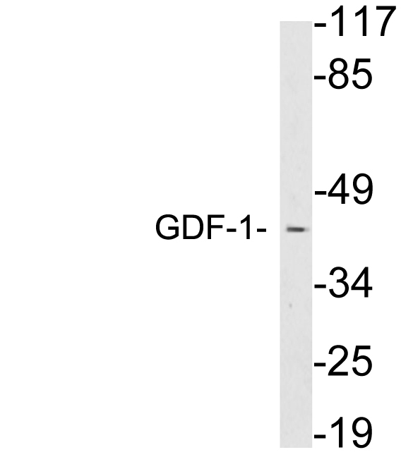 Anti-GDF-1 Antibody
