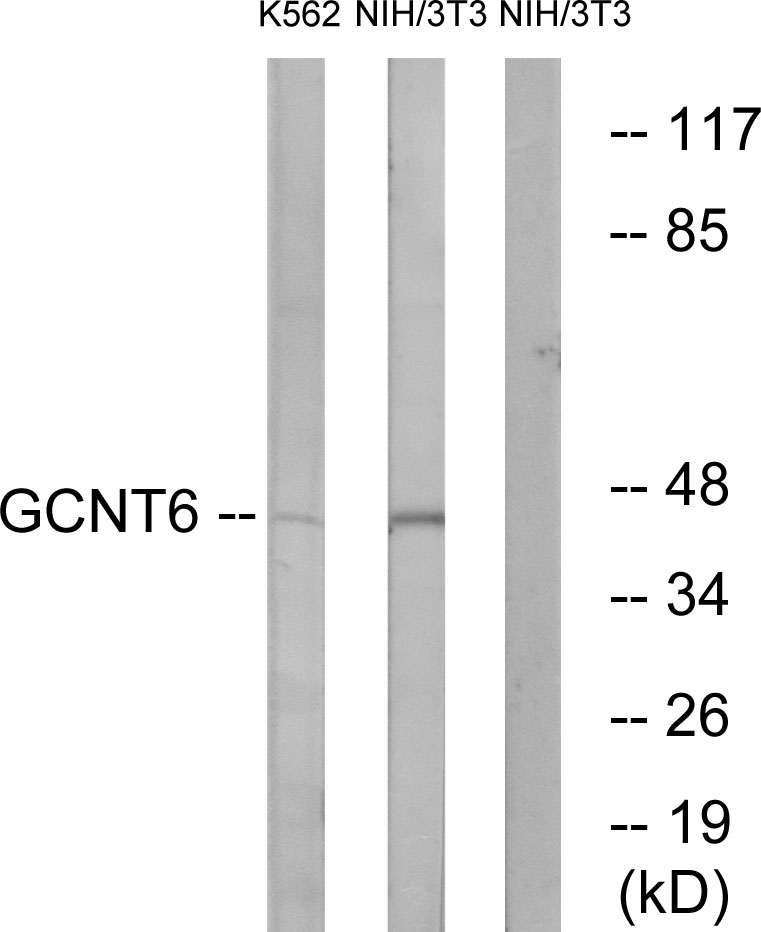 Anti-GCNT6 Antibody
