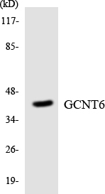 Anti-GCNT6 Antibody