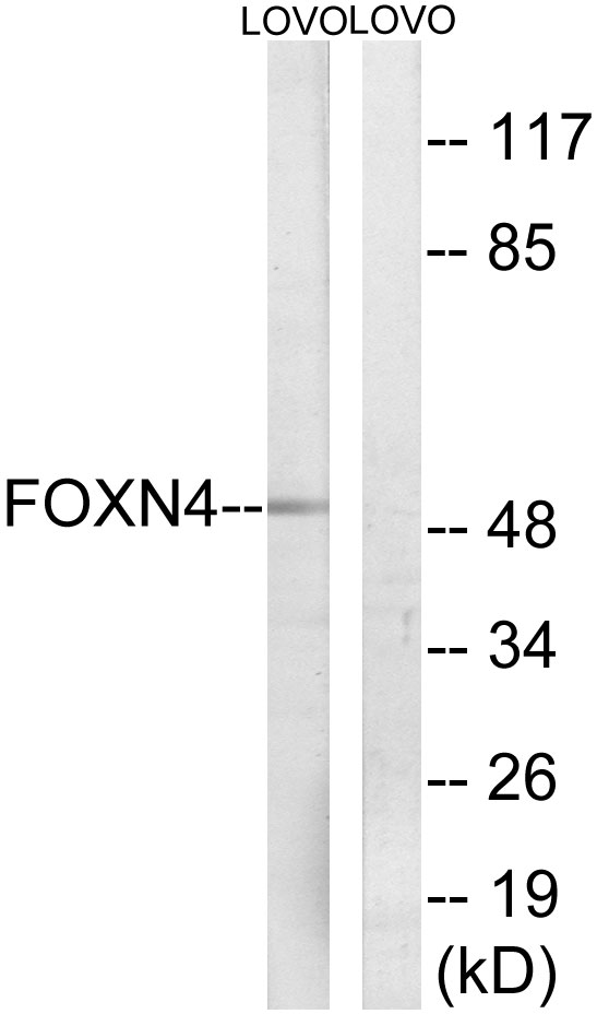 Anti-FOXN4 Antibody