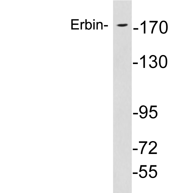 Anti-Erbin Antibody