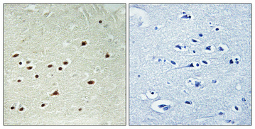 Anti-DDX51 Antibody Anti-DDX51 Antibody