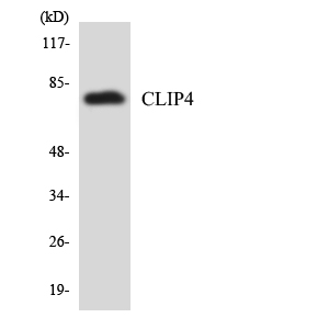 Anti-CLIP4 Antibody