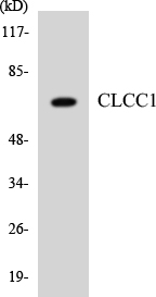 Anti-CLCC1 Antibody