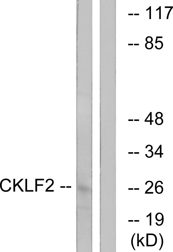 Anti-CKLF2 Antibody