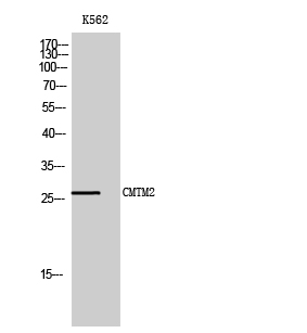 Anti-CKLF2 Antibody Anti-CKLF2 Antibody