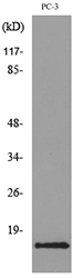 Anti-CCL26 Antibody - Identical to Abcam (ab190669)
