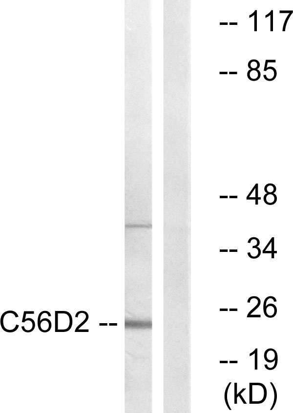 Anti-C56D2 Antibody