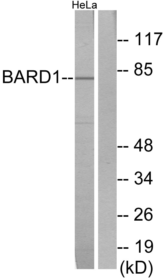 Anti-BARD1 Antibody