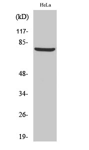 Anti-BARD1 Antibody Anti-BARD1 Antibody