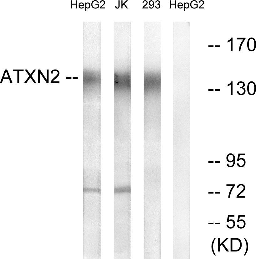 Anti-ATXN2 Antibody