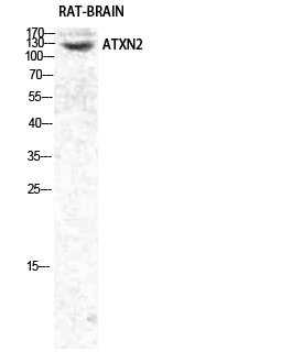 Anti-ATXN2 Antibody Anti-ATXN2 Antibody