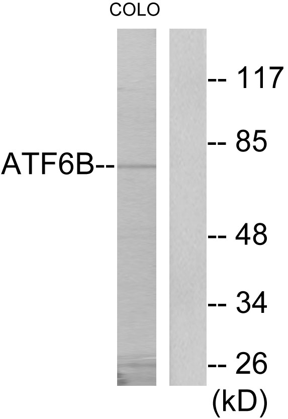 Anti-ATF6B Antibody