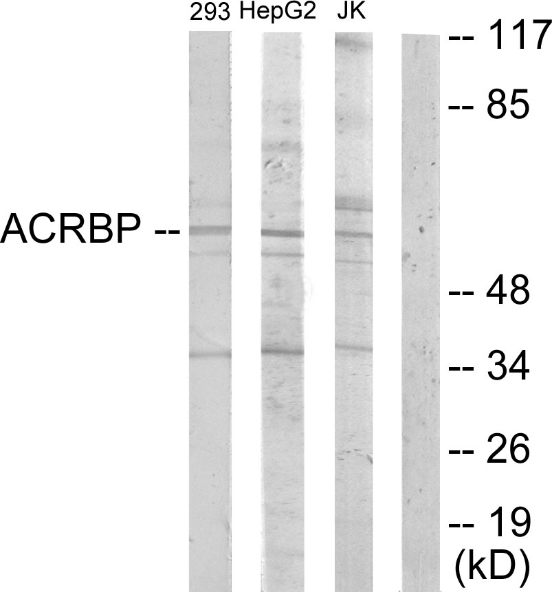 Anti-ACRBP Antibody