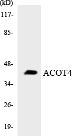 Anti-ACOT4 Antibody