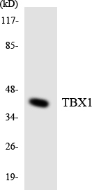 Anti-TBX1 Antibody