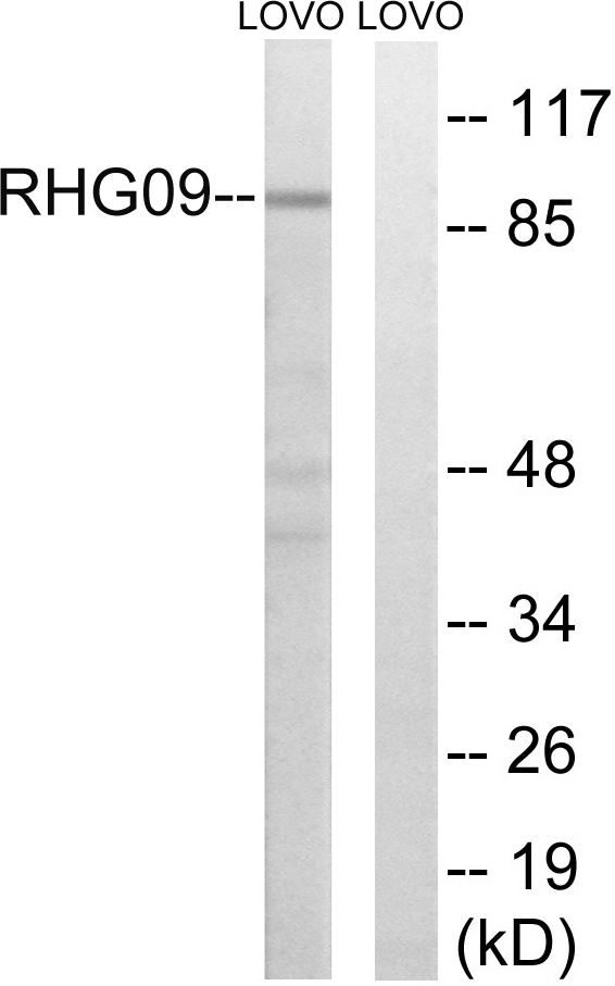 Anti-RHG9 Antibody