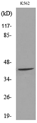 Anti-RHAG Antibody
