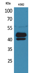 Anti-PSG1 Antibody Anti-PSG1 Antibody