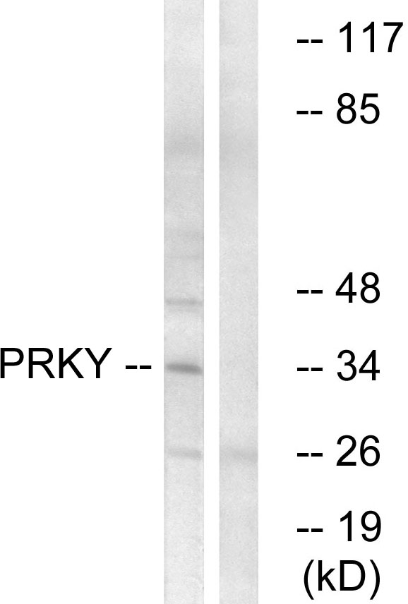 Anti-PRKY Antibody