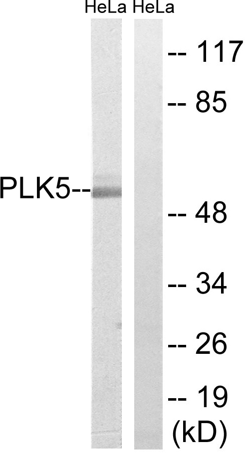 Anti-PLK5 Antibody