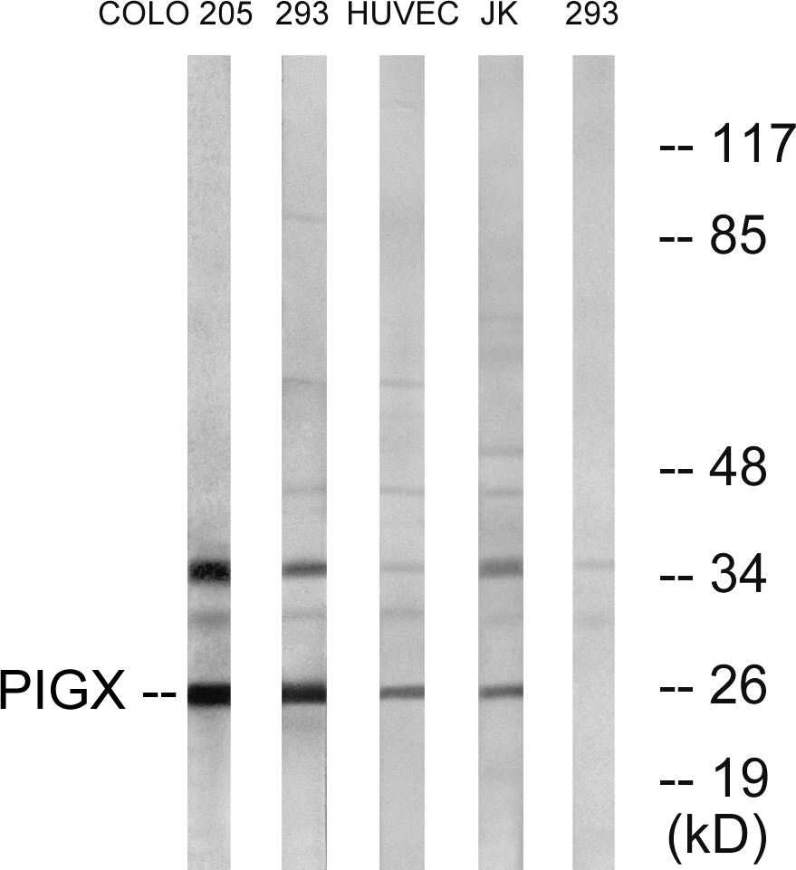 Anti-PIGX Antibody
