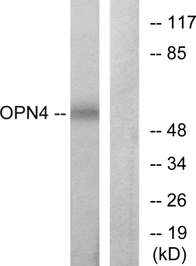 Anti-OPN4 Antibody