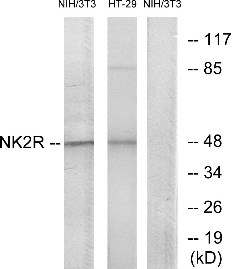 Anti-NK2R Antibody
